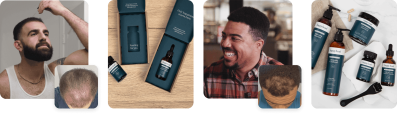 Happy Head Coupon: Just Pay $59 Per Month For 6 Months of  Personalized Hair Regrowth Treatments!